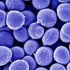 Methicillin-resistente Staphylococcus aureus (MRSA). Raster-Elektronenmikroskopie. Maßstab = 500 nm. Quelle: Muhsin Özel, Gudrun Holland, Rolf Reissbrodt (2004) 